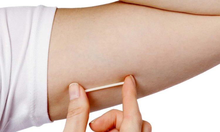 Condom का झंझट खत्म! अब न खानी पड़ेगी दवा, न सहना होगा दर्द, एक बार लगवा लीजिए यह 1 चीज फिर सालों तक रहें टेंशन फ्री